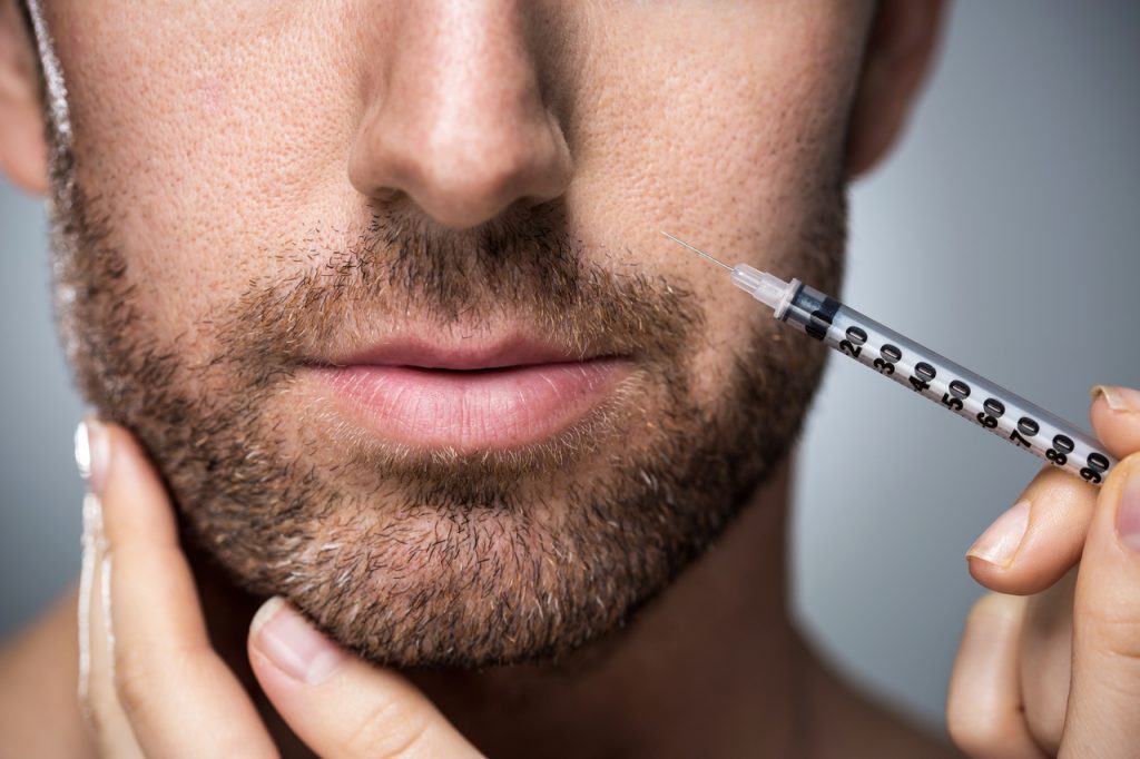 Man getting lip injection filler.
