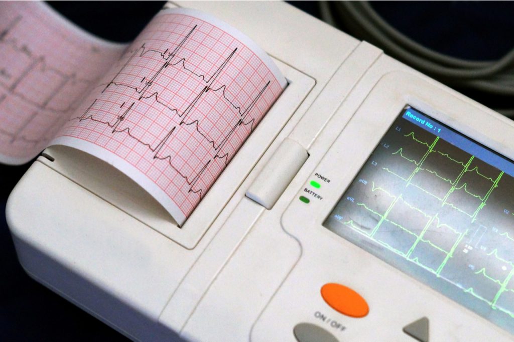 An ECG Machine used to diagnose Afib caused by low carb diets.
