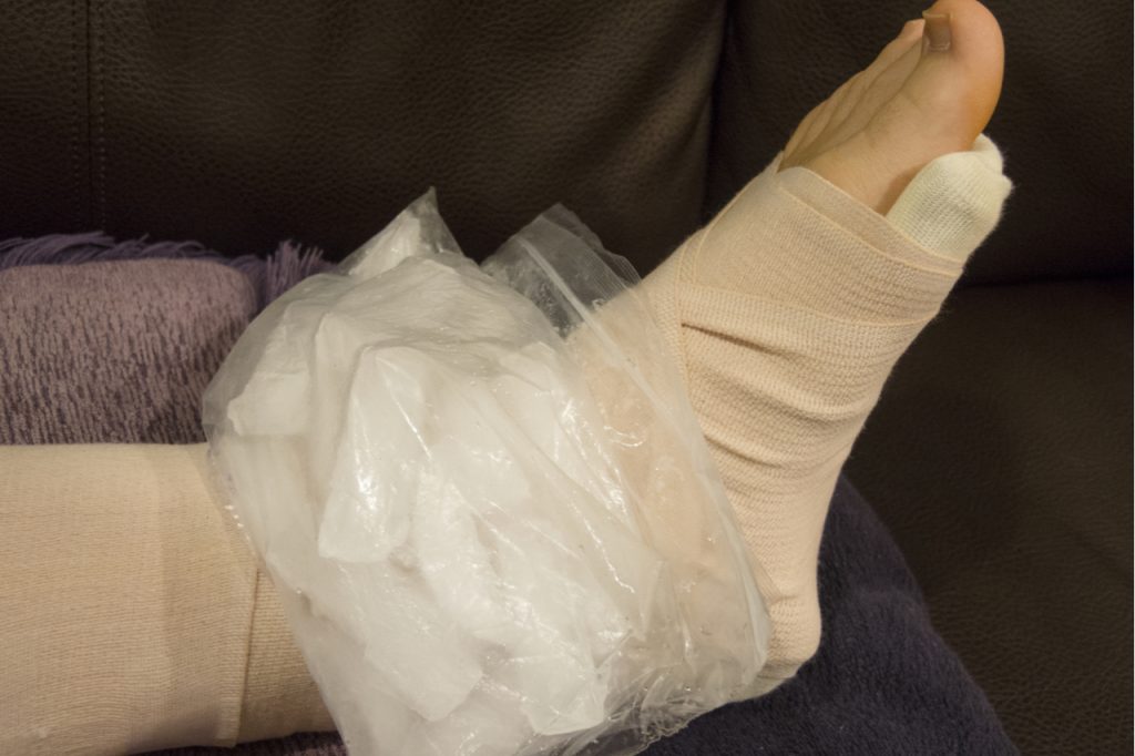 Ice pack applied on the sprained ankle.
