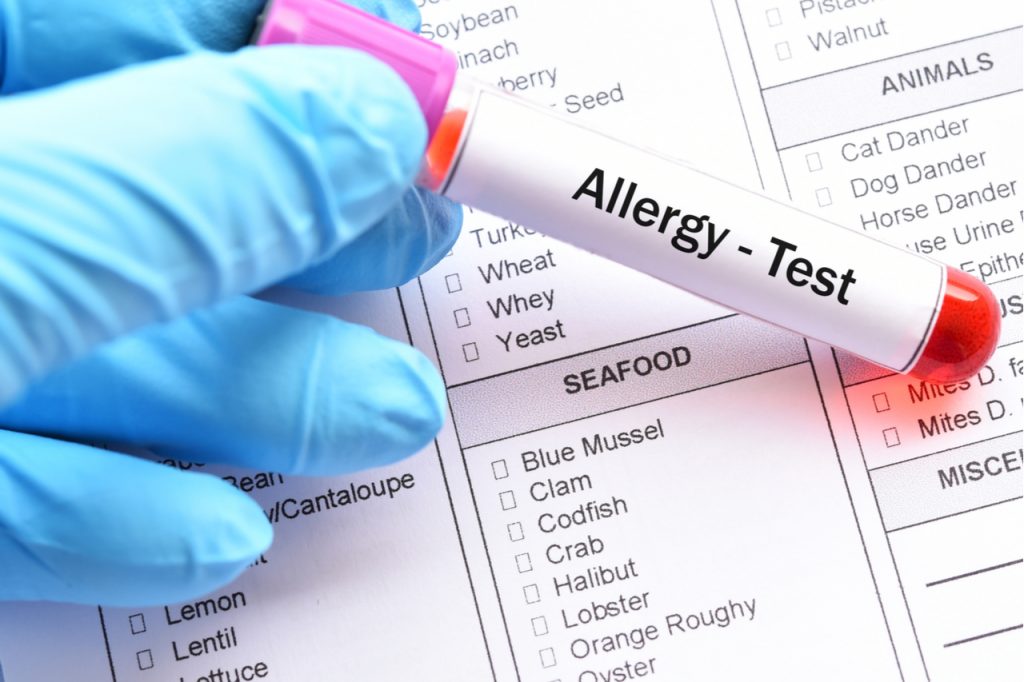 Test tube with blood sample for food sensitivity test.