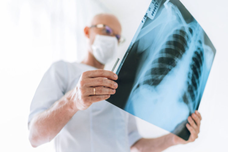 Mature Male doctor examining the patient chest x-ray film lungs scan